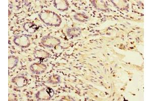 Immunohistochemistry of paraffin-embedded human small intestine tissue using ABIN7159912 at dilution of 1:100 (TIMM9 anticorps  (AA 2-89))