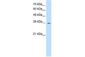 WB Suggested Anti-TRPM5 Antibody Titration:  0. (TRPM5 anticorps  (N-Term))