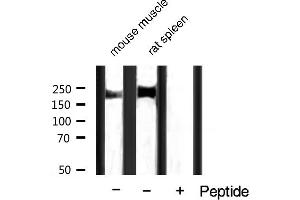 Western blot analysis of extracts of various tissue samples,using Phospho-HER2 (Tyr1248) Antibody.