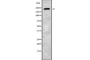 Western blot analysis of CHD2 using HT29 whole cell lysates (CHD2 anticorps  (C-Term))
