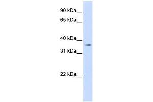 TMEM30B antibody used at 1 ug/ml to detect target protein.