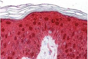 Human Skin: Formalin-Fixed, Paraffin-Embedded (FFPE)