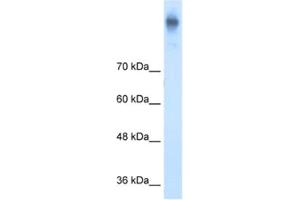 Western Blotting (WB) image for anti-Solute Carrier Family 12 (Potassium-Chloride Transporter) Member 2 (SLC12A2) antibody (ABIN2462733) (SLC12A2 anticorps)