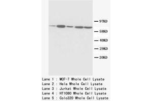 Image no. 1 for anti-Succinate Dehydrogenase Complex, Subunit A, Flavoprotein (Fp) (SDHA) (C-Term) antibody (ABIN1493069) (SDHA anticorps  (C-Term))