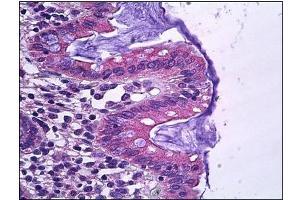 Human Colon, Epithelium: Formalin-Fixed, Paraffin-Embedded (FFPE) (SLC12A2 anticorps)