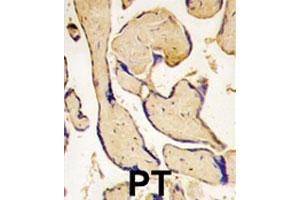 Formalin-fixed and paraffin-embedded human placenta tissue reacted with EPHA3 polyclonal antibody , which was peroxidase-conjugated to the secondary antibody, followed by DAB staining. (EPH Receptor A3 anticorps  (C-Term))