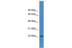 WB Suggested Anti-OTUB2 Antibody Titration: 0. (OTUB2 anticorps  (N-Term))