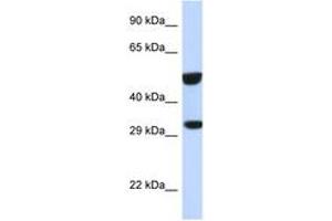 Image no. 1 for anti-V-Ets Erythroblastosis Virus E26 Oncogene Homolog 2 (ETS2) (AA 311-360) antibody (ABIN6747755) (ETS2 anticorps  (AA 311-360))