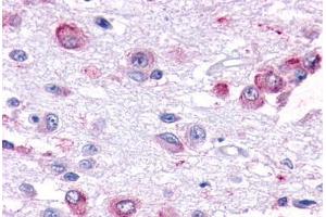 Human Brain, Hypothalamus (formalin-fixed, paraffin-embedded) stained with GPR101 antibody ABIN291950 at 7. (GPR101 anticorps  (Cytoplasmic Domain))