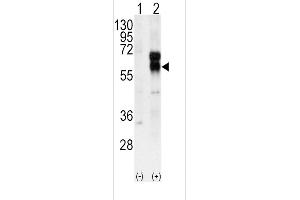 Western blot analysis of ACVRL1 using rabbit polyclonal ACVRL1 Antibody using 293 cell lysates (2 ug/lane) either nontransfected (Lane 1) or transiently transfected with the ACVRL1 gene (Lane 2). (ACVRL1 anticorps  (N-Term))