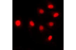 Immunofluorescent analysis of SIN3B staining in HCT116 cells. (SIN3B anticorps  (Center))