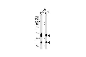 Western blot analysis of lysates from Daudi, Raji cell line (from left to right), using CD74 Antibody (ABIN1944838 and ABIN2838498).