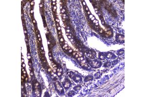 IHC analysis of GDA using anti-GDA antibody .