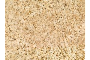 Alanine Transaminase Mouse Monoclonal Antibody at 1/100 staining rat heart tissue by IHC-P.