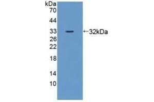 Detection of Recombinant ZRF1, Mouse using Polyclonal Antibody to Zuotin Related Factor 1 (ZRF1)