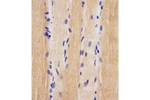 (ABIN6242880 and ABIN6578225) staining USP47 in human skeletal muscle tissue sections by Immunohistochemistry (IHC-P - paraformaldehyde-fixed, paraffin-embedded sections).
