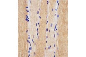 (ABIN6242880 and ABIN6578225) staining USP47 in human skeletal muscle tissue sections by Immunohistochemistry (IHC-P - paraformaldehyde-fixed, paraffin-embedded sections). (USP47 anticorps  (AA 588-620))