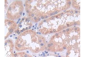 DAB staining on IHC-P; Samples: Human Kidney Tissue
