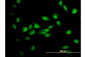 Immunofluorescence of monoclonal antibody to MDS028 on HeLa cell. (ITFG2 anticorps  (AA 1-447))