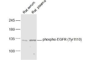 Lane 1: Rat serum lysates Lane 2: Rat plasma lysates probed with phospho-EGFR (Tyr1110) Polyclonal Antibody, Unconjugated  at 1:1000 dilution and 4˚C overnight incubation. (EGFR anticorps  (pTyr1110))