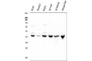 anti-Cystathionase (Cystathionine gamma-Lyase) (CTH) (AA 181-398) antibody