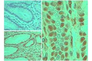 Caspase-8 Immunohistochemistry.