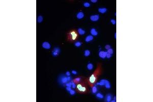 Transfected cell immunofluorescence: COS-1 cells expressing myc-tagged human Co-Rest.