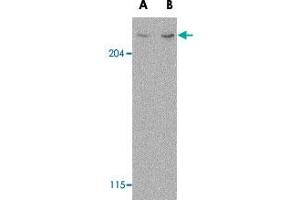 Western blot analysis of MTOR in L1210 cell lysate with MTOR polyclonal antibody  at (A) 1 and (B) 2 ug/mL . (MTOR anticorps  (N-Term))