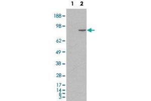 HEK293 overexpressing human CTNNA1 and probed with CTNNA1 polyclonal antibody  (mock transfection in first lane), tested by Origene. (CTNNA1 anticorps  (Internal Region))