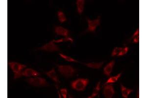 ABIN6267435 staining 293 by IF/ICC.