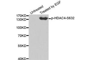 Western blot analysis of extracts from 293 cells using Phospho-HDAC4-S632 antibody. (HDAC4 anticorps  (pSer632))