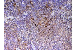 anti-Inducible T-Cell Co-Stimulator (ICOS) (AA 21-200) antibody