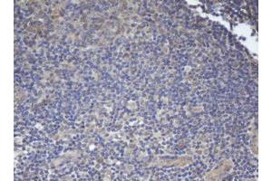 Image no. 2 for anti-B-Cell CLL/lymphoma 10 (BCL10) antibody (ABIN1496847) (BCL10 anticorps)