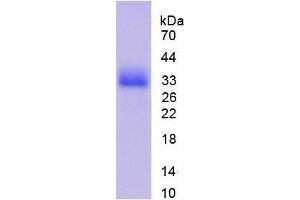 SDS-PAGE (SDS) image for Cyclin-Dependent Kinase 1 (CDK1) (AA 13-297) protein (His tag) (ABIN1099003) (CDK1 Protein (AA 13-297) (His tag))