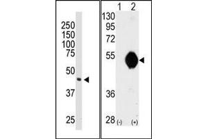 Image no. 1 for anti-DOK2 (DOK2) (C-Term) antibody (ABIN359960) (DOK2 anticorps  (C-Term))
