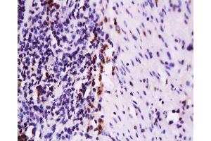 Formalin-fixed and paraffin embedded rat colon tissue labeled with Anti-Fas Polyclonal Antibody, Unconjugated  at 1:200 followed by conjugation to the secondary antibody and DAB staining