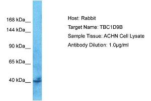 Host: Rabbit Target Name: TBC1D9B Sample Tissue: Human ACHN Whole Cell  Antibody Dilution: 1ug/ml (TBC1D9B anticorps  (C-Term))