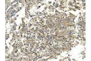 IHC analysis of EEF2 using anti-EEF2 antibody (ABIN7603141). (EEF2 anticorps  (N-Term))