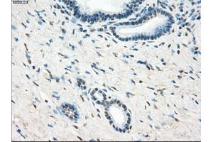Immunohistochemical staining of paraffin-embedded Ovary tissue using anti-LTA4H mouse monoclonal antibody. (LTA4H anticorps)