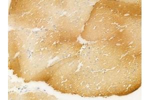 ABIN6265804 and ABIN6266666 at 1/100 staining human normal gastric tissue by IHC-P. (gamma Tubulin anticorps  (N-Term))
