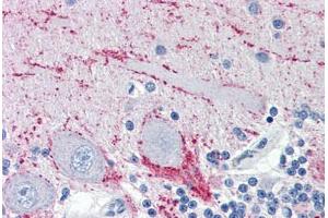 anti-Vesicle-Associated Membrane Protein 2 (Synaptobrevin 2) (VAMP2) (AA 1-89) antibody