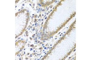 Immunohistochemistry of paraffin-embedded human stomach using EIF4E antibody.