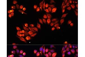 Immunofluorescence analysis of HeLa cells using Heparanase 1 Polyclonal Antibody at dilution of 1:100. (HPSE anticorps)