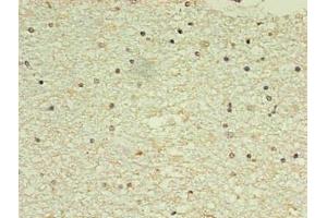 Immunohistochemistry of paraffin-embedded human brain using  in 30 μg/mL dilute concentrations.