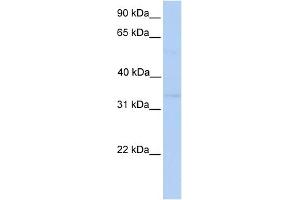 WB Suggested Anti-NDE1 Antibody Titration: 0. (NDE1 anticorps  (Middle Region))