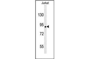 Western blot analysis of KIAA1680 Antibody (C-term) in Jurkat cell line lysates (35ug/lane). (MGC48628 (AA 787-816), (C-Term) anticorps)