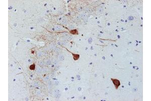 Immunostaining of paraffin embedded section of mouse brain (dilution 1 : 500). (PVALB anticorps)