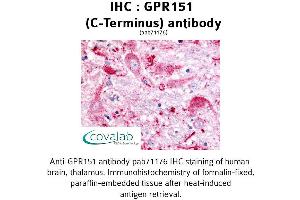 Image no. 1 for anti-G Protein-Coupled Receptor 151 (GPR151) (C-Term) antibody (ABIN1734966) (GPR151 anticorps  (C-Term))