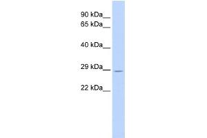 WB Suggested Anti-TRIM55 Antibody Titration:  0. (TRIM55 anticorps  (Middle Region))
