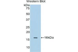 Detection of Recombinant CDK1, Human using Polyclonal Antibody to Cyclin Dependent Kinase 1 (CDK1) (CDK1 anticorps  (AA 59-182))
